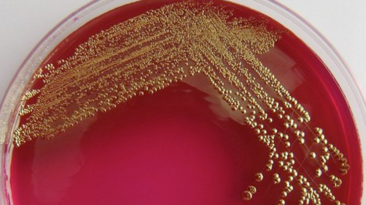 Dig into the DNA of Delftia—the microbe that poops gold | NC State  University Libraries